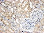 SNX8 Antibody in Immunohistochemistry (Paraffin) (IHC (P))