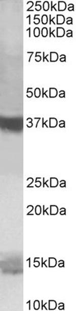 PFDN1 Polyclonal Antibody