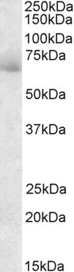 AKAP10 Polyclonal Antibody