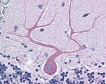 MRCK alpha Antibody in Immunohistochemistry (Paraffin) (IHC (P))
