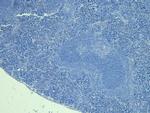 FOXP3 Antibody in Immunohistochemistry (Paraffin) (IHC (P))