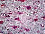 EHD1 Antibody in Immunohistochemistry (Paraffin) (IHC (P))