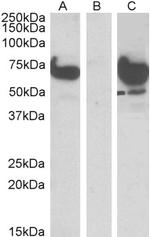 EPM2AIP1 Polyclonal Antibody