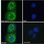 LPIN2 Antibody in Immunocytochemistry (ICC/IF)