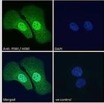 PIWIL1 Polyclonal Antibody