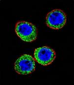 CD10 Antibody in Immunocytochemistry (ICC/IF)