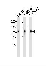 CD10 Antibody in Western Blot (WB)