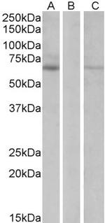 MKRN1 Polyclonal Antibody