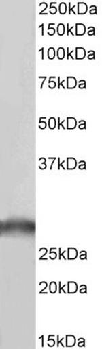 SDHB Antibody in Western Blot (WB)