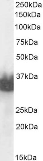 PSA Antibody in Western Blot (WB)