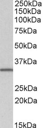 NHERF2 (Isoform B/E) Polyclonal Antibody