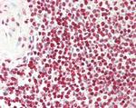 FOXP3 Antibody in Immunohistochemistry (Paraffin) (IHC (P))