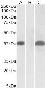 PIM2 Polyclonal Antibody