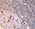 TPH2 Antibody in Immunohistochemistry (Paraffin) (IHC (P))