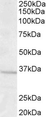 GNB3 Polyclonal Antibody