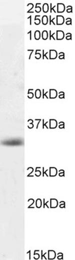 Caspase 3 Antibody in Western Blot (WB)