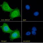 ZNF217 Polyclonal Antibody