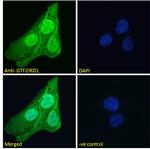 GTF2IRD1 Polyclonal Antibody