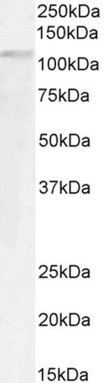 GTF2IRD1 Antibody in Western Blot (WB)