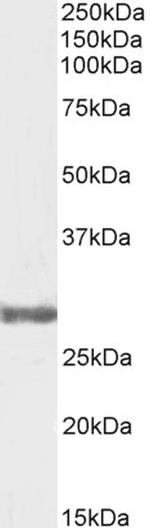 COMT Polyclonal Antibody, Biotin
