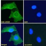 LHR Polyclonal Antibody