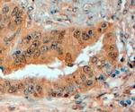SEMA3E Antibody in Immunohistochemistry (Paraffin) (IHC (P))