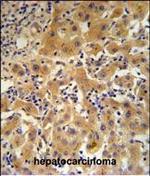 Ceruloplasmin Polyclonal Antibody