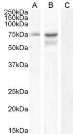 NCDN Polyclonal Antibody