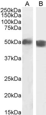 Carabin Antibody in Western Blot (WB)