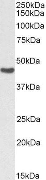 ASS1 Polyclonal Antibody, Biotin