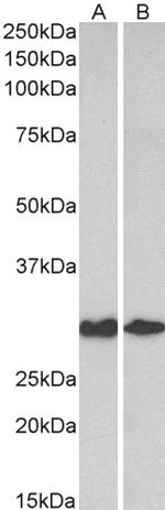 Galectin 3 Polyclonal Antibody
