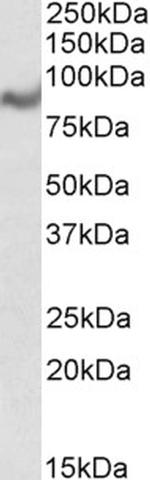 MIC-1 Antibody in Western Blot (WB)