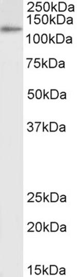 IDE Polyclonal Antibody, Biotin