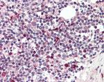 TFEC Antibody in Immunohistochemistry (Paraffin) (IHC (P))
