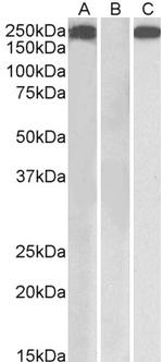Thrombospondin 1 Polyclonal Antibody