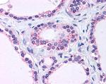 RPL22 Antibody in Immunohistochemistry (Paraffin) (IHC (P))