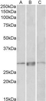 PRRX1 Polyclonal Antibody