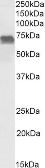 PRICKLE3 Polyclonal Antibody