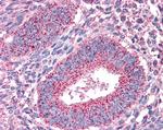 PTPRM Antibody in Immunohistochemistry (Paraffin) (IHC (P))