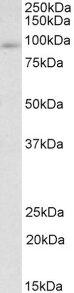 ADAP Polyclonal Antibody