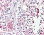 HRASLS Antibody in Immunohistochemistry (Paraffin) (IHC (P))