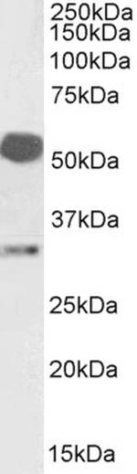 Estrogen Receptor beta Polyclonal Antibody
