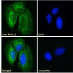 MUC13 Polyclonal Antibody