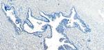 CEP290 Antibody in Immunohistochemistry (Paraffin) (IHC (P))
