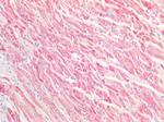 GOT2 Antibody in Immunohistochemistry (Paraffin) (IHC (P))