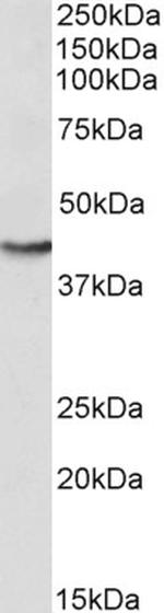 GOT2 Antibody in Western Blot (WB)