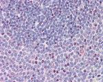 SRC3 Antibody in Immunohistochemistry (Paraffin) (IHC (P))