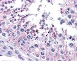 FZD9 Antibody in Immunohistochemistry (Paraffin) (IHC (P))