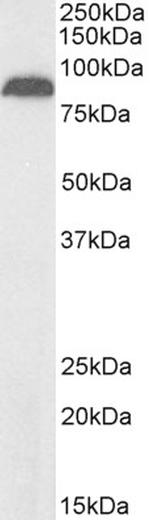 TRPV5 Polyclonal Antibody, Biotin