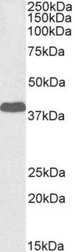 EPM2A Polyclonal Antibody, Biotin